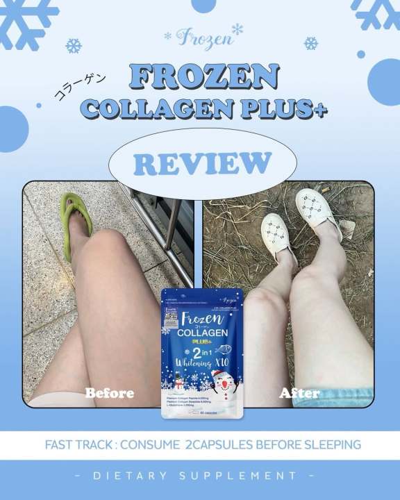 Frozen%20Collagen%20Plus+%202%20in%201%20Whitening%2010x%20Premium%20Skin%20Elasticity%20Capsules%20-%20Made%20in%20Thailand%20-%20Image%204