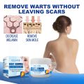 Eelhoe Skin Tag Remover Warts & Mole Remover Cream Remove Skin Tag Wart Callus Natural Ingredients Scar-Free Wart Ointment 30G. 