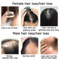 Neo Hair Lotion For Hair Growth Green Wealth. 