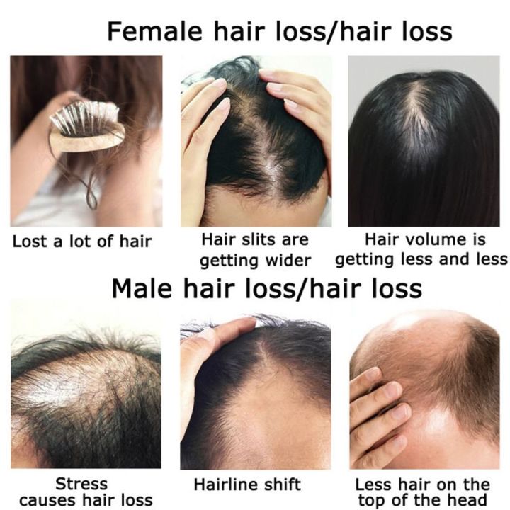 Neo%20Hair%20Lotion%20For%20Hair%20Growth%20Green%20Wealth%20-%20Image%206