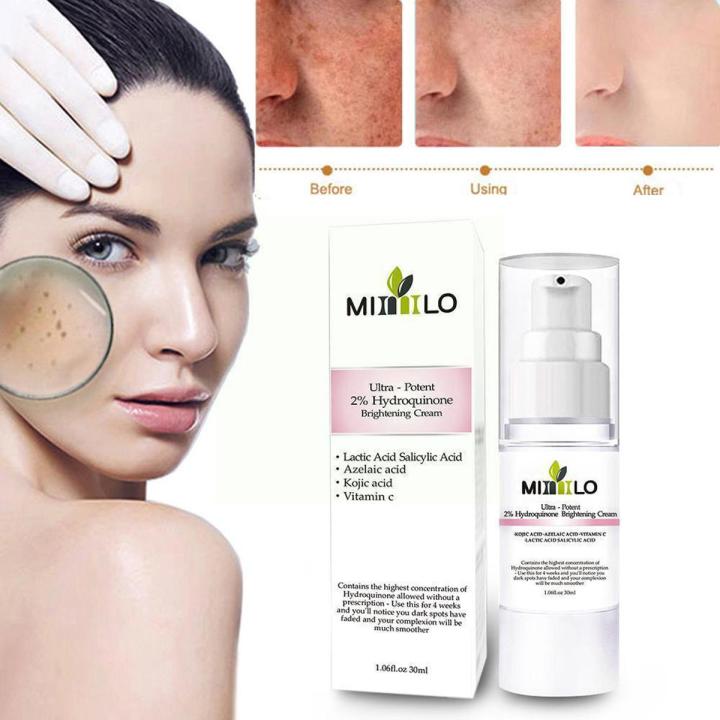 2% Hydroquinone Dark Spot Corrector Remover Face Melasma Cream Treatment Fade T3Z5