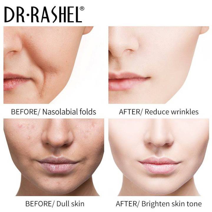 DR.Rashel%20Vitamin%20C%20Brightening%20Complexion%20Anti%20aging%20Reduces%20Redness%20Face%20Wash%20100g%20DRL-%201634%20-%20Image%209