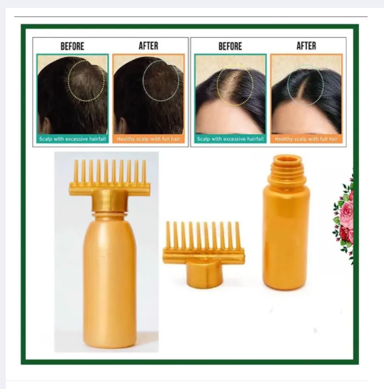 Hair Oil Bottle With Comb - Root Comb Applicator - Best Professional Hair Oil Applicator Bottle - Best For Dandruff & Hair Fall - Imported Product