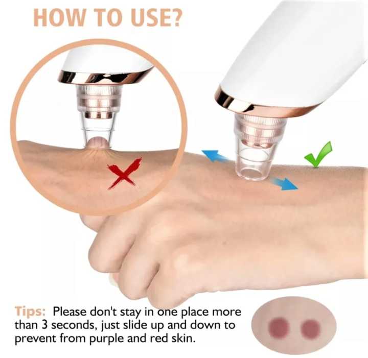 5%20in%201%20Multifunction%20Blackhead%20Removal%20Rechargeable%20Machine%20%7C%20White%20Head%20Vacuum%20Suction%20Face%20Pore%20Cleaner%20Nose%20Sucking%20Extractor%20%7C%20Blackheads%20Removal%20Device%20Derma%20Suction%20Chargeable%20-%20Image%206
