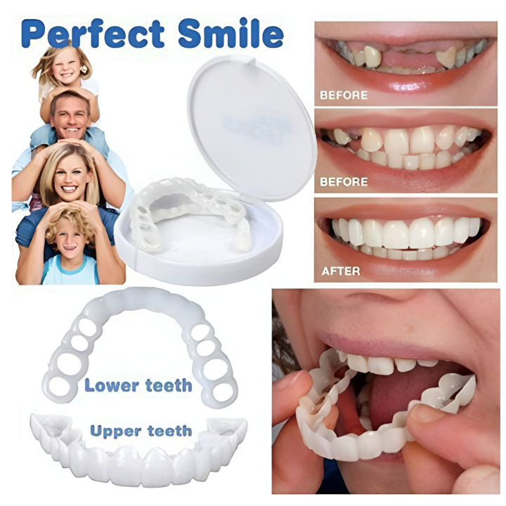 Premium Silicone Decorative Braces – Realistic Fake Braces for Fashion | Artificial Teeth Braces Kit | Non-Metal, Easy-to-Wear Silicone Braces for Teens & Adults