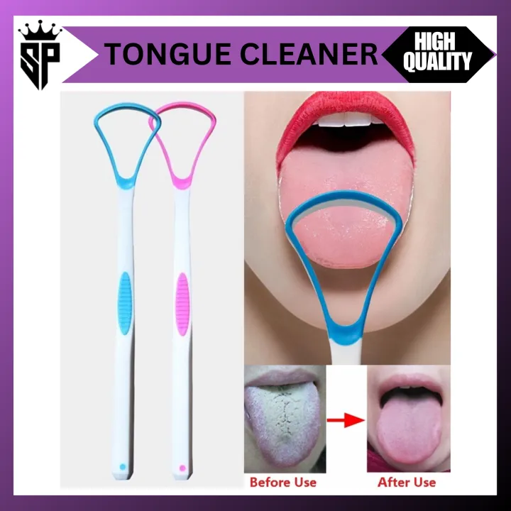 SP%20Dealz%20High%20Quality%20Silicone%20Tongue%20Scraper%20Tongue%20Cleaner%20Plastic.%20-%20Image%202