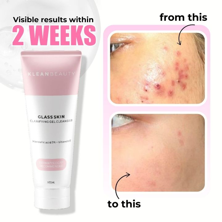 Klean%20Beauty%20Clarifying%20Gel%20Facewash%20100ml%20/%2050ml%20Korean%20glass%20skin%20%7C%20deeply%20cleanses%20pores%20%7C%20controls%20oil%20%7C%20reduces%20wrinkles%20%7C%20dark%20circles%20%7C%20acne%20scars%20%7C%20brightens%20%7C%20%20rejuvenates%20%7C%20radiant%20%7C%20glass-skin%20glow%20%7C%20Perfect%20for%20all%20skin%20types%20-%20Image%203