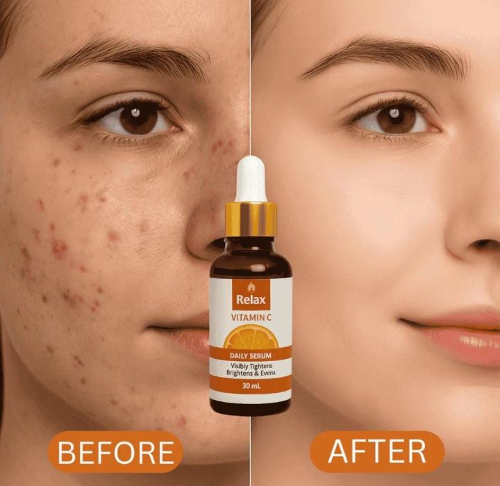 Relax%20Vitamin%20C%20Daily%20Serum%2030ml%20-%20Brightening%20Tightening%20and%20Even%20Tone%20Formula%20-%20Image%203