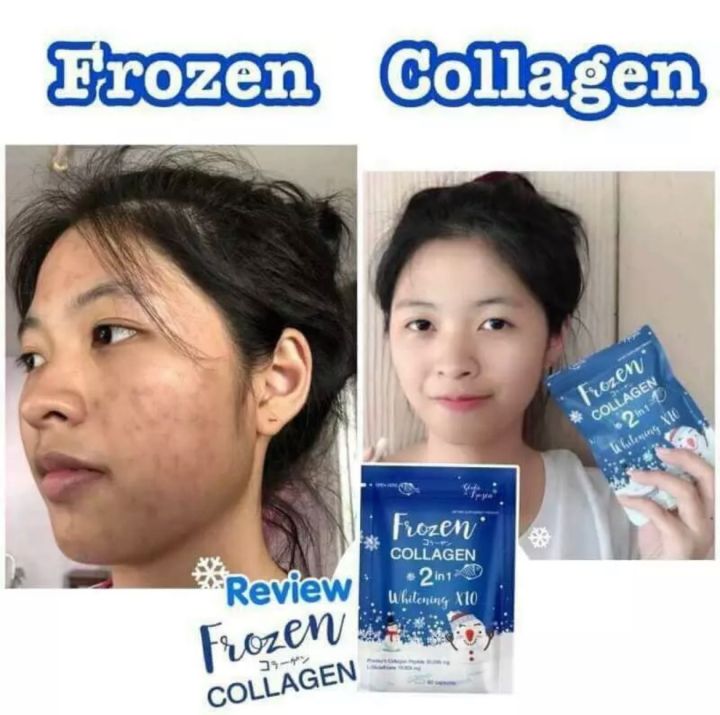 Frozen  colagin 2in1