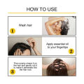Natural Ginger Hair Growth Products For Men And Women Anti Hair Loss Oil Fast Regrowth Thicken Scalp Hair Growth Serum 30g. 