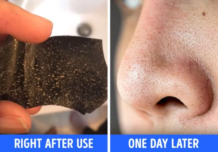 Pack%20of%206%20Deep%20Cleansing%20Nose%20Pore%20Strips%20for%20Blackhead%20Removal%20Random%20Brands%20-%20Image%207