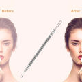 Dexam Blackhead Remover Loop Professional Blackhead & Whitehead Remover Tool for Blemish Comedone Pimple Popper with Double Sided Soft Touch and Anti-Slip Design. 