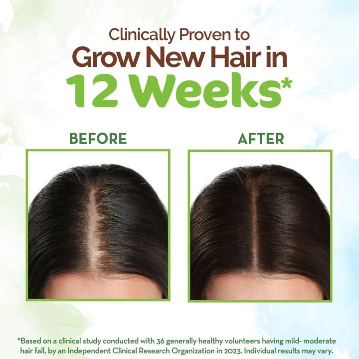 MAMAEARTH%20%20Rosemary%20Anti-Hair%20Fall%20Shampoo%20%20with%20Methi%20Dana%20%7C%20Controls%20Hair%20Loss%20&%20Breakage%20%7C%20Build%20Up%20Clarifying%20&%20Hydrating%20Formula%20300ML%20-%20Image%203