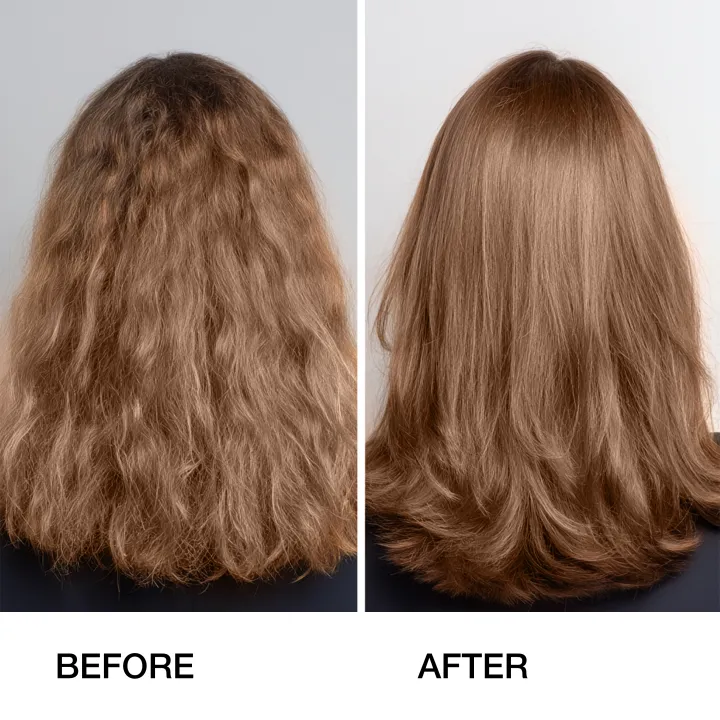 GK%20Hair%20Anti-Dandruff%20Shampoo%20250ml%20%E2%80%93%20For%20Itchy%20Scalp,%20Dandruff%20Control%20&%20Frizz-Free%20Hair%20%7C%20Sulfate-Free%20%7C%20For%20Men%20&%20Women%20%7C%20Imported%20-%20Image%207