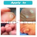 CORN CAP (Foot Care) PACK OF 5. 