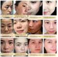 CHALONESE Brightening Cream Serum 20g Anti Freckle Dark Spot Remover Skin Tone Corrector Glow Cream Herbal Gentle Formula Face Serum for Women Men. 