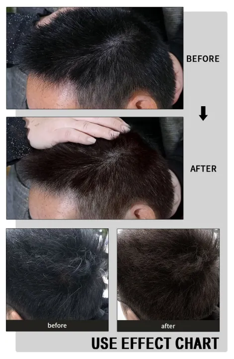 Lichen%20Professional%20Black%20Hair%20Shampoo%20with%20Nourishing%20Ingredients%20-%20Single%20Pack,%20Stain-Free%20Hair%20Dye%20for%20Men%20&%20Women%20-%20400%20mL%20-%20Image%205