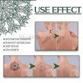 Green Algae Tattoo Removal Spray Painless Scarless Quick Removal Maximum Strength Body Tattoo Cleaning Fades Tattoos 30ML. 