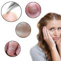 Professional Manicure Pedicure Kit Nail Clipper ,Double Headed Cuticle Pusher and Toe Nail Pin Set Beauty Instruments For Men and Women, Stainless Steel Ingrown Toenail Fungus Treatment Tool Fingernail Clipper Trimmer Nail Cleaner Tools. 