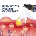 30ml Vein Healing Varicose Veins Treatment Spray Essential Oil Relief Phlebitis Angiitis Remedy Pain Spray Relief Leg Pain Spine Pain. 