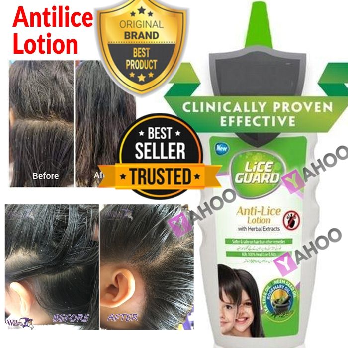 Lice Killer Oil Anti Lice Lice Removal Lotion Serum - Safe With No Side Effects No Chemicals - Best for All Ages - for lices and nits