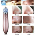 Black Head Remover Machine XN 8030 Rechargeable Pore Cleaner Vacuum Negative Pressure Acne Pore Cleanser 4 Changeable Head. 