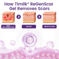 Timilk RegenScar Cream | Advanced Scar Removal Cream | Acne Marks, Stretch Marks & Dark Spots Treatment | Skin Repair Formula. 