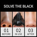 SEVICH 5PCS Blackhead Removal Deep Cleansing Skin Pore Mask 6g. 
