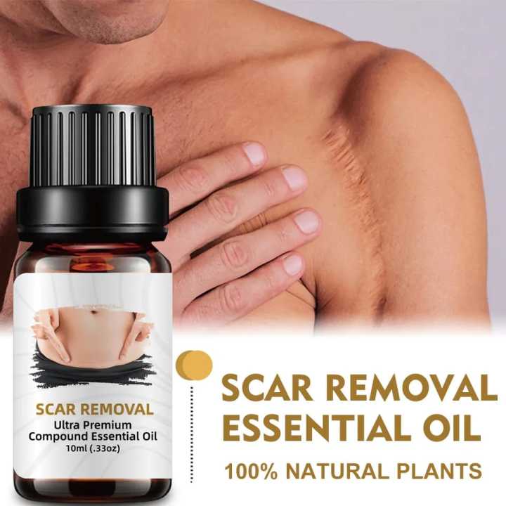 10ml Scar Removal Essential Oil Ultra Premium Compound Essential Oils for Massage Face Body Skin Care Scars Repair Acne Burn