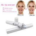 Blue Light Facial Machine Acne Wrinkle Removal Laser Pen Skin Spots Removal Anti Varicose Spider Vein Eraser Medical Treatment. 