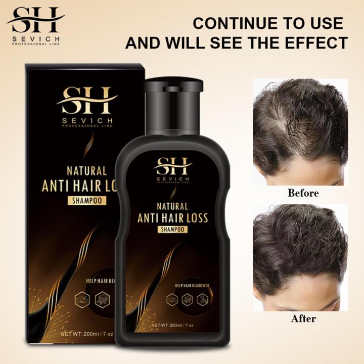 SEVICH Anti Hair Loss Shampoo 200ml Ginger Essence Hair Shampoo
