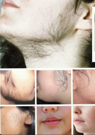 VANIFALL%20CREAM%20(13.9%25)%2015g%20baby%20-%20Image%204