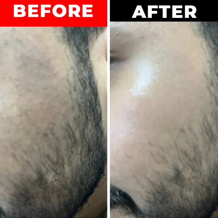 Rano%20Kojic%20Acid%20Whitening%20Facial%20Soap%20135gr%20%7C%207-Day%20Skin%20Lightening%20%7C%20For%20Sensitive%20&%20Oily%20Skin%20-%20Image%209