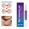 Warts Removal Pen Eliminate Wart Pen Wart Liquid Hand Foot Warts Remove Filiform Wart. 