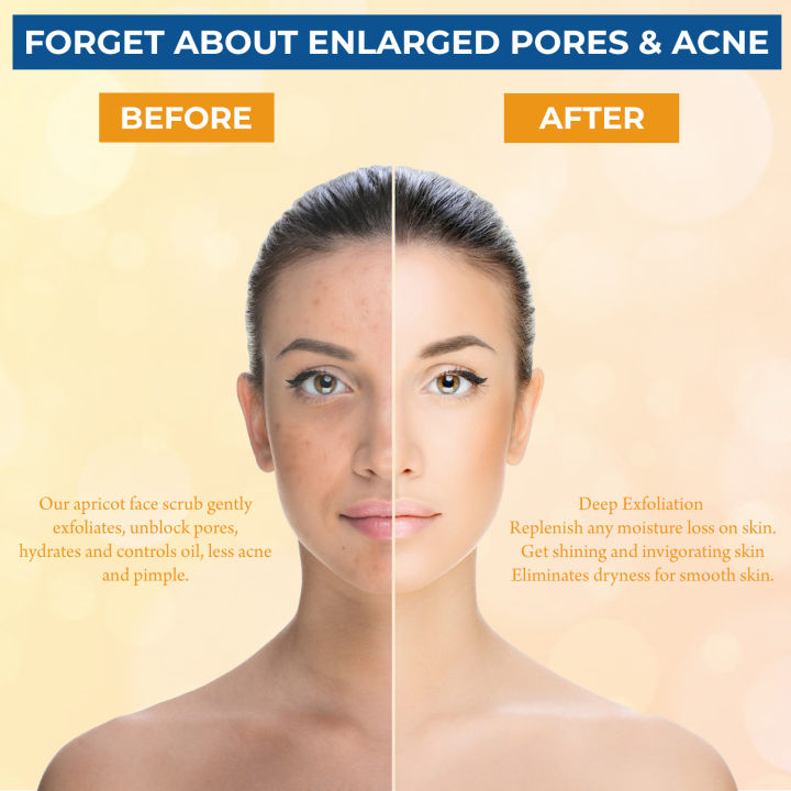 Apricot%20Face%20Scrub%20-%20Brightening%20&%20Exfoliating%20Scrub%20For%20Face%20&%20Body%20-%20125g%20-%20Image%204