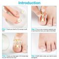 Ingrown Toenails Nail Corrector Foot Toe Nail Straightening Clip Fixer Stainless Steel Medical Clipper Recove Professional Toenails Lifter Feet Acronyx Bunion Repair For Nails Pliers. 