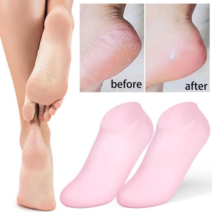 Silicone%20Gel%20Heel%20Pad%20Socks%20For%20Pain%20Relief%20And%20Anti%20Crack%20Heel%201%20Pair%20Heel%20Cups%20Heel%20Guards%20Heel%20Protectors%20Heel%20Sleeves%20For%20Relieve%20Heel%20Pads%20Cushion%20Heel%20Pain,%20Heal%20Dry%20Cracked%20Heels,%20Achilles%20Tendinitis,%20For%20Men%20&%20Women%20-%20Image%202