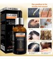 100% Original Ginger Hair Growth Oil Scalp Care Anti Hair Loss Serum 30ml. 