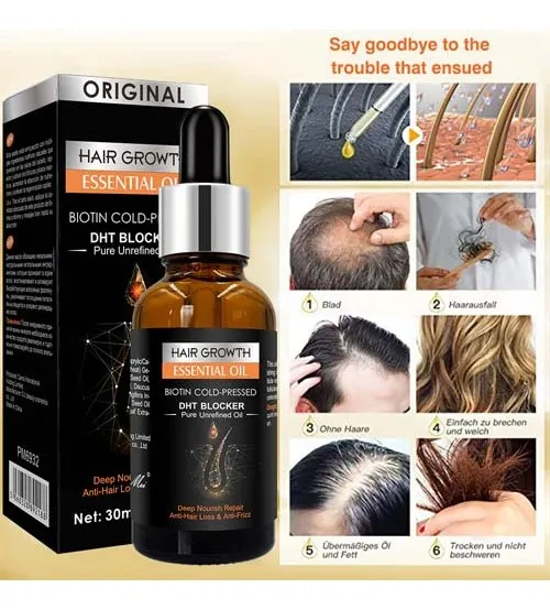 100%25%20Original%20Ginger%20Hair%20Growth%20Oil%20Scalp%20Care%20Anti%20Hair%20Loss%20Serum%2030ml%20-%20Image%204