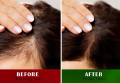 Silk Heaven Hair Remedy Oil 125ml oil for hair grow | 100% original and Herbal | Gentle & Nourishing Hair Care. 