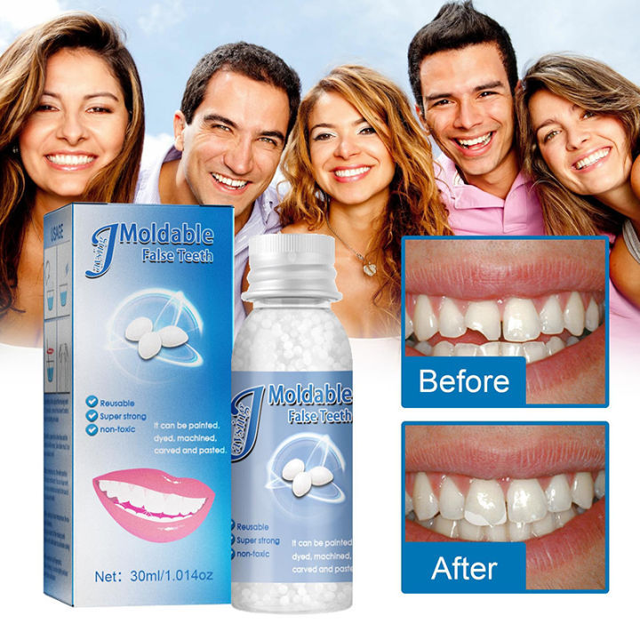 30g%20Resin%20False%20Teeth%20Solid%20Glue%20Temporary%20Tooth%20Repair%20Denture%20Adhesive%20Teeth%20Creek%20-%20Image%203