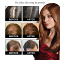 Natural Ginger Hair Growth Products For Men And Women Anti Hair Loss Oil Fast Regrowth Thicken Scalp Hair Growth Serum 30g. 