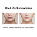 Volcanic Face Roller Easy to Clean Volcanic Stone Oil Absorbing Rolling Ball. 