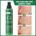 Uptown LA Women's Anti-Acne Face Toner with 2% Salicylic Acid - 100m. 