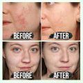 Lichen Blackhead Remover Mask, Peel Off Face Mask, Charcoal Face Mask for Black Head Remover, Skin Deep Cleansing for Face Nose Blackhead Pores Acne, Women & Men Face Skin Care - 100 ml. 