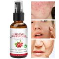 30ml Rosehip Oil Organic Rose Hips Face Oils Fast-Absorbing Skin Care Moisturizer Face Oil Organic Rosehip Seed Oil Essence. 