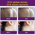 jjmakro 【SFDA approval number 】Lipoma Care Cream. 