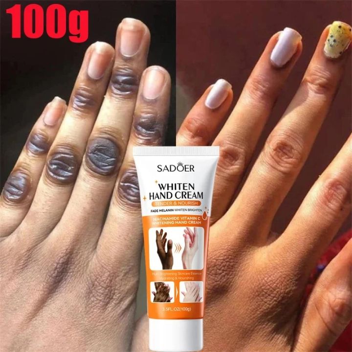 Sadoer%20Dark%20Knuckles%20Fast%20Whitening%20Anti%20Cracking%20Cream%20Niacinamide%20Vitamin%20C%20Whaitening%20Hand%20Cream%20SD04130%20-%20Image%203