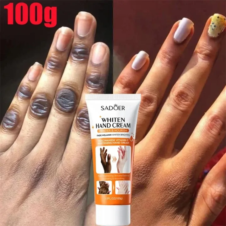 Sadoer%20Dark%20Knuckles%20Fast%20Whitening%20Anti%20Cracking%20Cream%20Niacinamide%20Vitamin%20C%20Whaitening%20Hand%20Cream%20SD04130%20-%20Image%204