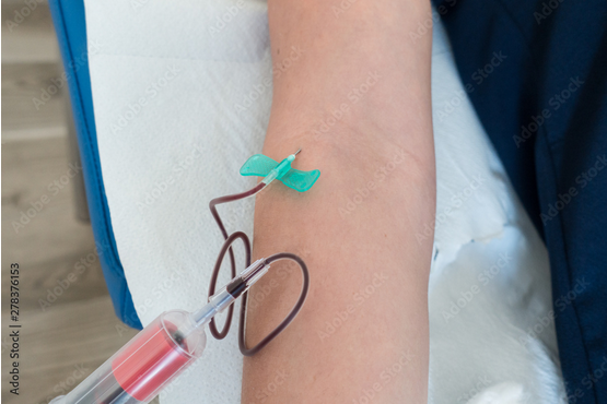 MULTI-SAMPLE%20NEEDLE%20WITH%20LUER%20ADAPTER%20SIZE%2023G/3/4%20-%20Image%202